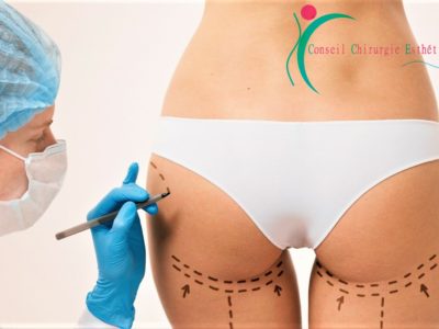 lipofilling avec le logo