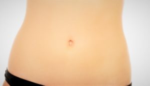 abdominoplastie