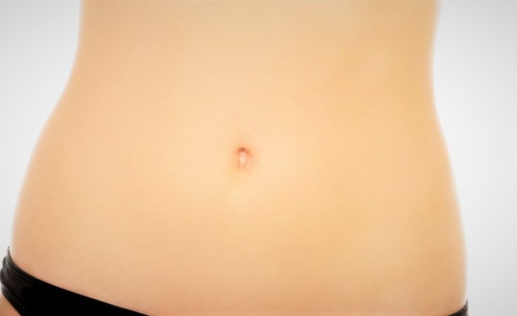 abdominoplastie