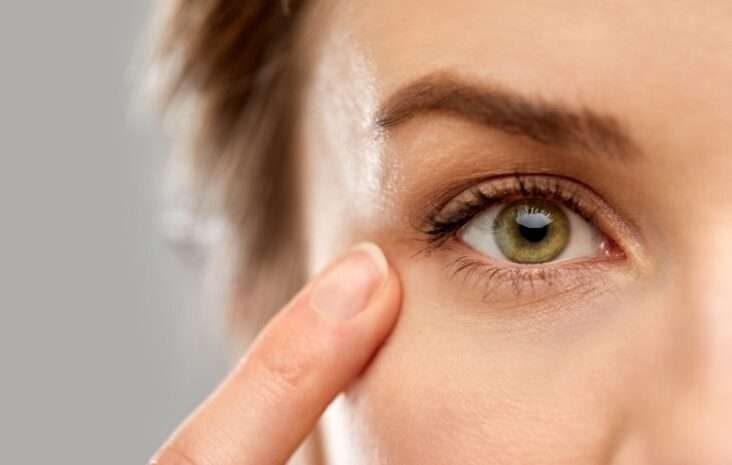 blépharoplastie