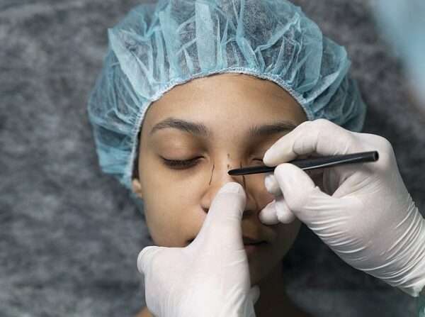 Chirurgie esthétique